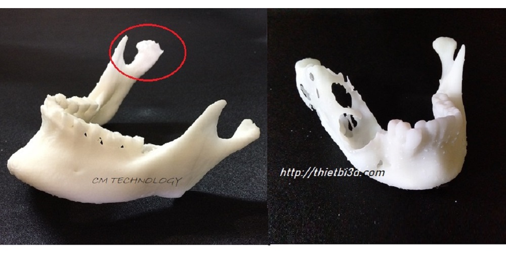 Mô hình xương hàm 3D